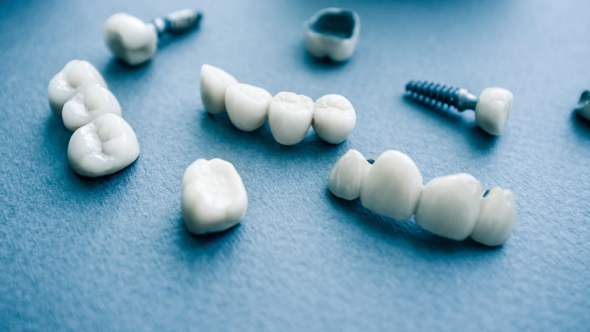 Surgical-Orthodontics-Ceramic-Dental-Implants-In-Canton.