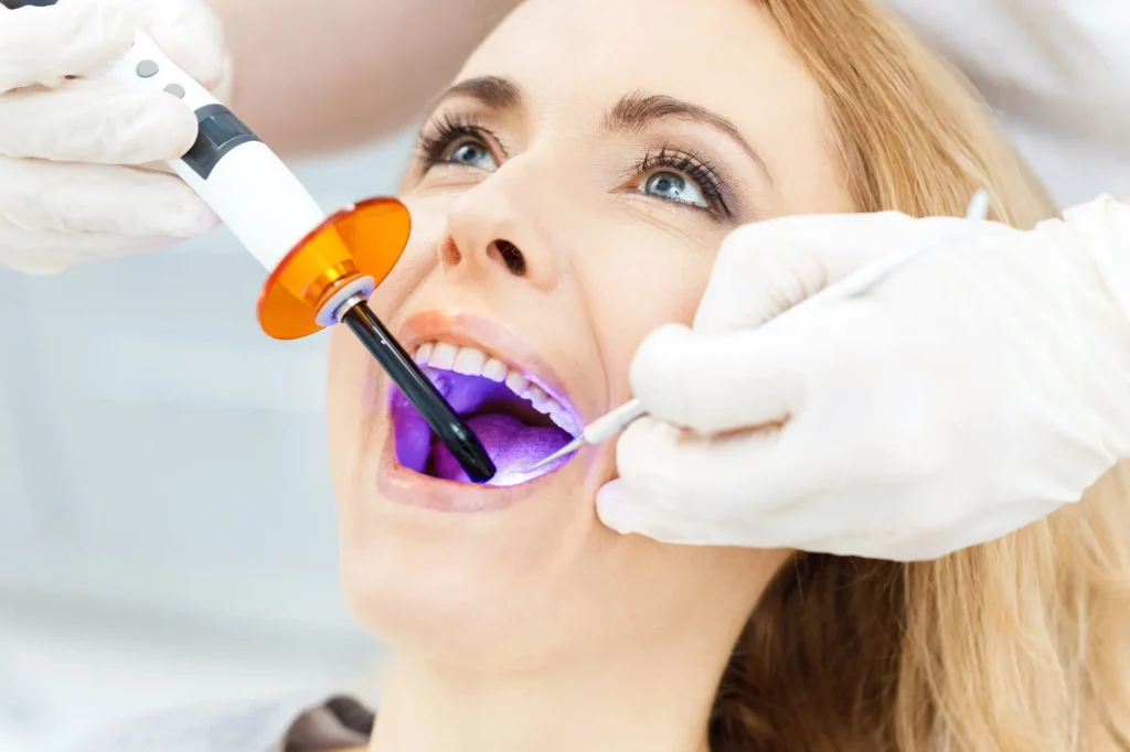 Patient Whitening Teeth At Dentist During A Full Mouth Restoration In Canton
