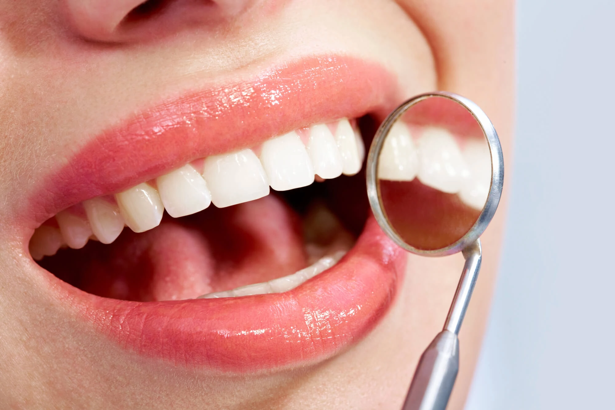 Dental Fillings Canton Michigan