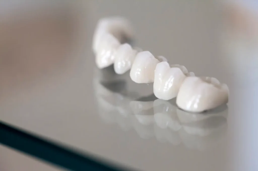 Zirconia Tooth Display For Crowns And Bridges Canton Michigan