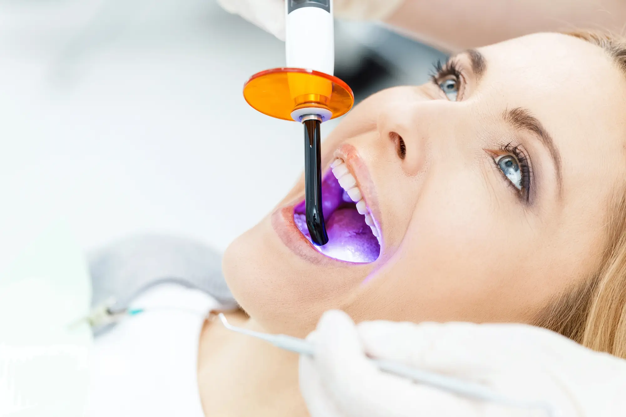 Professional Teeth Whitening In Canton