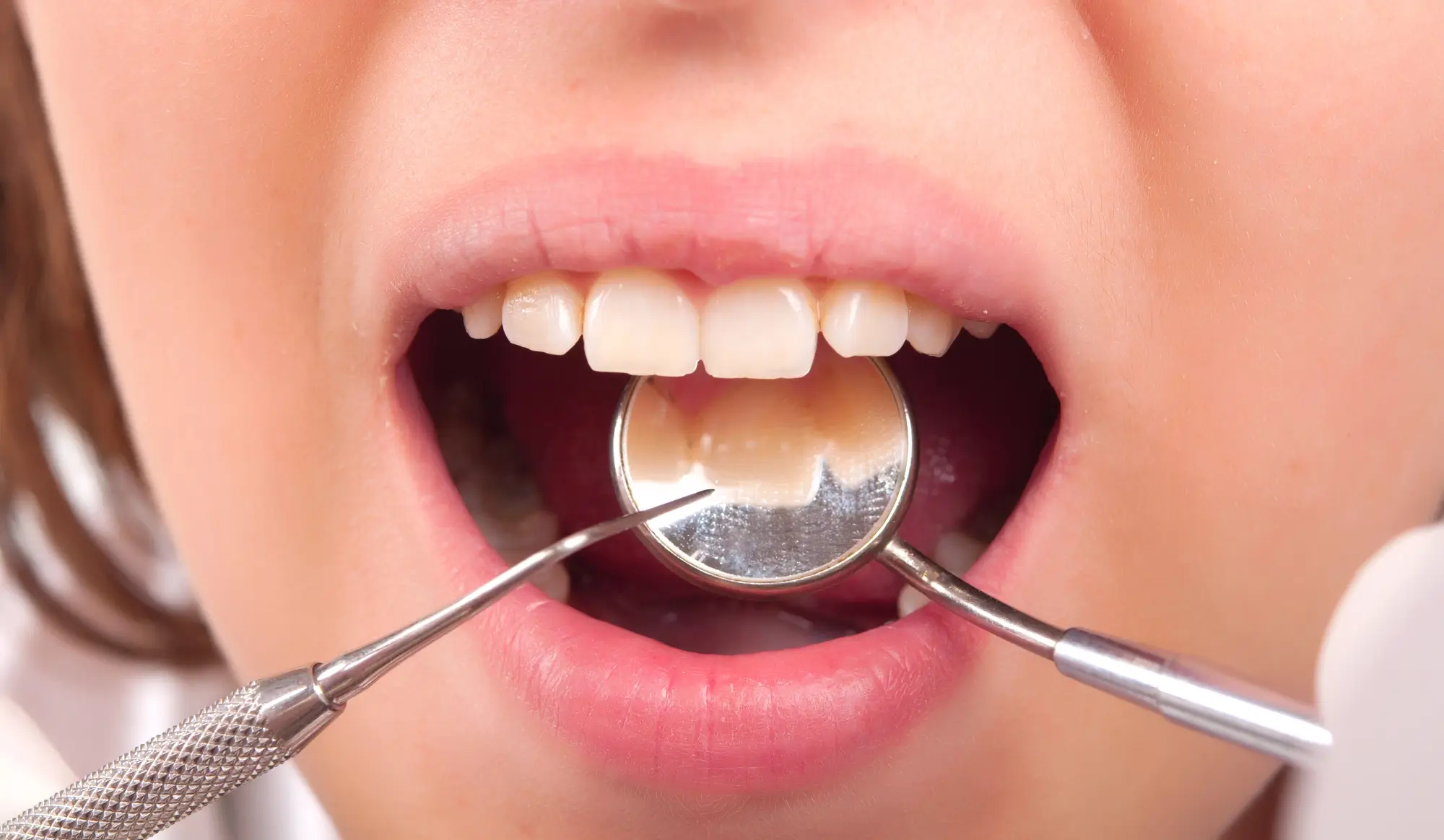 Dental Treatment At Clinic By Gum Disease Treatment Canton Specialist